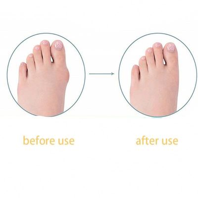 TPR Adulte Détracteur de gros pieds Bunion Correction jour/nuit Enfants Détracteur de pouce pour chaussures